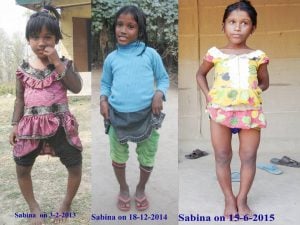 <p>Sabina has slowly recovered from the effects of fluorosis after treatment [image courtesy: Dharani Saikia]</p>